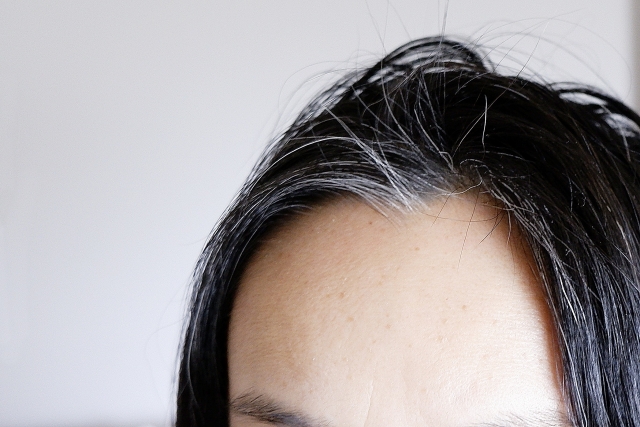 白髪