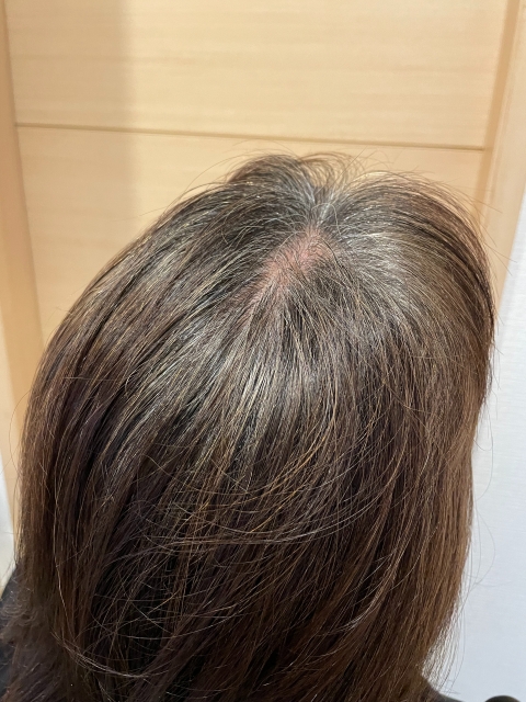 白髪 部分染め
